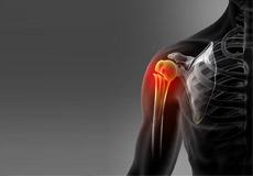 Fracture Care